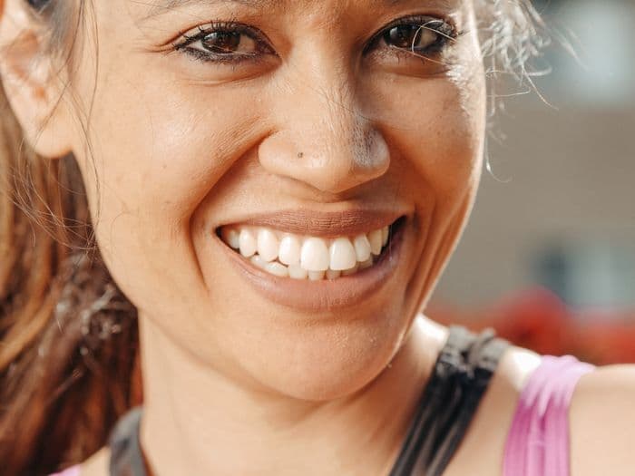 Woman showing confident bright smile after smile makeover treatment